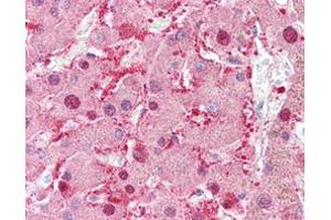 Immunohistochemical staining (Formalin-fixed paraffin-embedded sections) of human liver with AKR1C1 monoclonal antibody, clone AT6D10 . (AKR1C1 Antikörper)