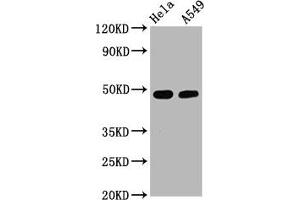 Western Blot Positive WB detected in Hela whole cell lysate,A549 whole cell lysate All lanes Phospho-GATA3 antibody at 2. (Rekombinanter GATA3 Antikörper  (pSer308))