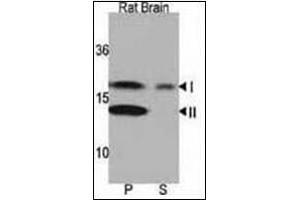 Western blot analysis of LC3 Antibody in Rat brain lysate. (MAP1LC3A Antikörper  (N-Term))