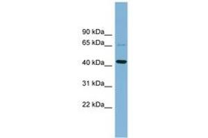 Image no. 1 for anti-UEV and Lactate/malate Dehyrogenase Domains (UEVLD) (AA 143-192) antibody (ABIN6742158) (UEVLD Antikörper  (AA 143-192))