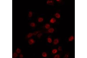 ABIN6266731 staining Hela by IF/ICC. (MBD3 Antikörper  (C-Term))