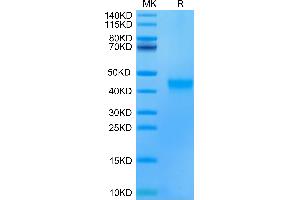 Human/Cynomolgus EFNA3 on Tris-Bis PAGE under reduced condition. (Ephrin A3 Protein (EFNA3) (AA 23-213) (His tag))