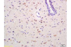 Formalin-fixed and paraffin embedded rat brain labeled with Rabbit Anti EPH receptor A4 Polyclonal Antibody, Unconjugated (ABIN734123) at 1:200 followed by conjugation to the secondary antibody and DAB staining (EPH Receptor A4 Antikörper  (AA 531-630))