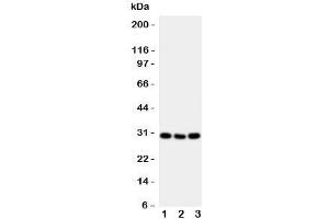 Western blot testing of CD134 antibody and mouse samples 1:  brain;  2: spleen;  3: liver tissue lysate. (TNFRSF4 Antikörper  (N-Term))
