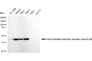 Western blotting analysis using ribonucleotide reductase regulatory subunit M2 antibody (ABIN7800213).