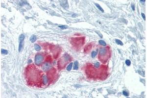 Human Colon, submucosal plexus: Formalin-Fixed, Paraffin-Embedded (FFPE) (FARSB Antikörper  (AA 234-342))