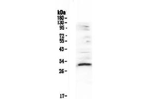 Western blot analysis of VEGFB using anti-VEGFB antibody . (VEGFB Antikörper  (AA 22-207))