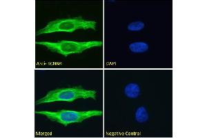 ABIN6391378 Immunofluorescence analysis of paraformaldehyde fixed HeLa cells, permeabilized with 0. (KCNN4 Antikörper  (Internal Region))