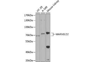 Western blot analysis of extracts of various cell lines, using M antibody  at 1:1000 dilution. (Tricellulin Antikörper  (AA 1-195))