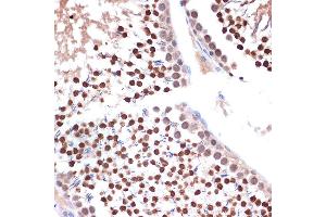 Immunohistochemistry of paraffin-embedded rat testis using NUP153 Rabbit mAb (ABIN1512527, ABIN3023298, ABIN3023299 and ABIN7101477) at dilution of 1:100 (40x lens).