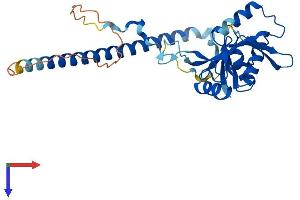 TSEN34 Protein (AA 1-310) (His tag)