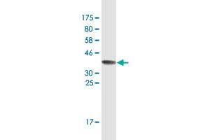 Western Blot detection against Immunogen (37. (RRM2 Antikörper  (AA 1-110))