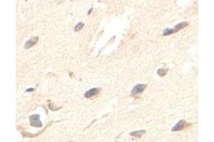 Immunohistochemical analysis of paraffin-embedded human fetal brain showing cytoplasmic staining with ZBED5 polyclonal antibody  at a 1 : 100 dilution. (ZBED5 Antikörper  (AA 224-474))