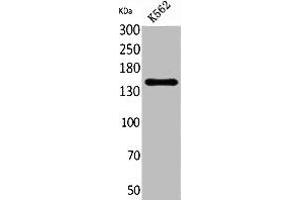 Western Blotting (WB) image for anti-Replication Factor C (Activator 1) 1, 145kDa (RFC1) (C-Term) antibody (ABIN7185477)