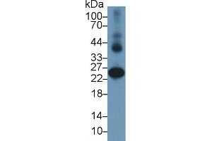 Detection of GSTa2 in Human Liver lysate using Polyclonal Antibody to Glutathione S Transferase Alpha 2 (GSTa2) (GSTa2 Antikörper  (AA 1-222))