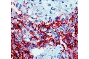 anti-Mesothelioma antibody