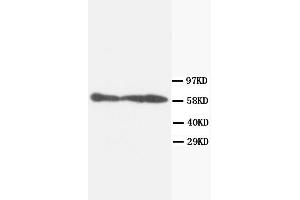 Western Blotting (WB) image for anti-Protein Phosphatase 3, Catalytic Subunit, alpha Isoform (PPP3CA) antibody (ABIN1108716) (PPP3CA Antikörper)