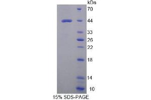 SDS-PAGE (SDS) image for Tryptophanyl tRNA Synthetase 2, Mitochondrial (WARS2) (AA 1-360) protein (His tag) (ABIN6239562)