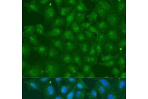 Immunofluorescence analysis of U2OS cells using ZBTB20 Polyclonal Antibody at dilution of 1:100.