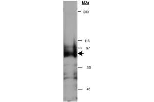 Western blot analysis of CYTSB in HeLa whole cell lysate (RIPA) using CYTSB polyclonal antibody  at 0. (NSP5 Antikörper  (AA 1-100))