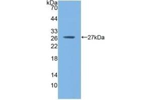 Detection of Recombinant GSTm1, Mouse using Polyclonal Antibody to Glutathione S Transferase Mu 1 (GSTM1) (GSTM1 Antikörper  (AA 1-218))