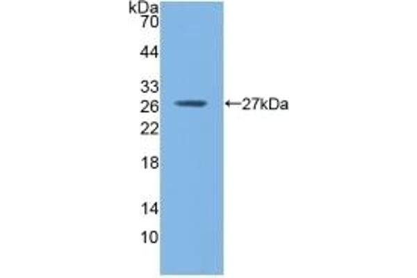 GSTM1 antibody  (AA 1-218)