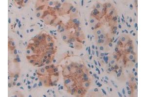 DAB staining on IHC-P; Samples: Human Stomach Tissue