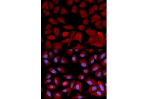 Immunofluorescence analysis of U2OS cells using PSMC4 antibody (ABIN5971339).