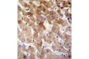 Immunohistochemistry analysis in formalin fixed and paraffin embedded human liver tissue reacted with MBTD1 Antibody (C-term) followed which was by peroxidase conjugated to the secondary antibody and followed by DAB staining. (MBTD1 Antikörper  (C-Term))