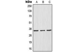 Western blot analysis of IKB alpha expression in HeLa (A), HepG2 (B), Raw264. (NFKBIA Antikörper  (N-Term))