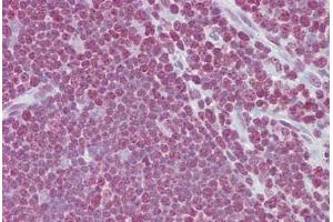 Anti-CD40LG / CD54 antibody IHC staining of human thymus. (CD40 Ligand Antikörper  (AA 108-157))