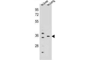Western blot analysis of KCNRG Antibody (C-term) in mouse liver,lung tissue lysates (35ug/lane). (KCNRG Antikörper  (C-Term))