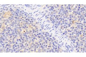 Detection of IkBz in Human Spleen Tissue using Polyclonal Antibody to Inhibitory Subunit Of NF Kappa B Zeta (IkBz) (Inhibitory Subunit of NF-KappaB zeta (AA 422-651) Antikörper)