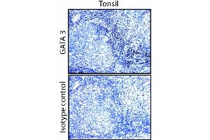 GATA3 staining on human tonsil and breast. (GATA3 Antikörper)