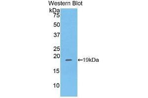 Western Blotting (WB) image for anti-Pleckstrin Homology-Like Domain, Family A, Member 2 (PHLDA2) (AA 9-140) antibody (ABIN7439669)