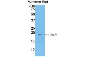 Detection of Recombinant PHLDA2, Mouse using Polyclonal Antibody to Pleckstrin Homology Like Domain Family A, Member 2 (PHLDA2) (PHLDA2 Antikörper  (AA 9-140))