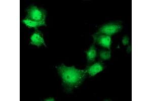 Anti-SHPK mouse monoclonal antibody (ABIN2454861) immunofluorescent staining of COS7 cells transiently transfected by pCMV6-ENTRY SHPK (RC204421). (SHPK Antikörper)