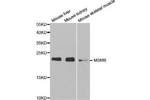 Western blot analysis of extracts of various cell lines, using MSMB antibody. (MSMB Antikörper)