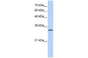 Sideroflexin 1 antibody used at 1 ug/ml to detect target protein. (SFXN1 Antikörper  (N-Term))