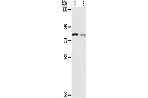 Gel: 6 % SDS-PAGE, Lysate: 40 μg, Lane 1-2: A549 cells, A172 cells, Primary antibody: ABIN7192629(SPATA5L1 Antibody) at dilution 1/200, Secondary antibody: Goat anti rabbit IgG at 1/8000 dilution, Exposure time: 2 minutes (SPATA5L1 Antikörper)