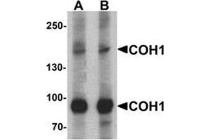 Western blot analysis of COH1 in SK-N-SH cell lysate with COH1 Antibody  antibody at (A) 1 and (B) 2 μg/ml.