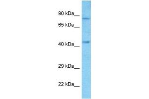 Host:  Rabbit  Target Name:  SIM2  Sample Type:  A549 Whole Cell lysates  Antibody Dilution:  1.