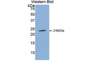 Western Blotting (WB) image for anti-TIMP Metallopeptidase Inhibitor 1 (TIMP1) (AA 25-207) antibody (ABIN1078585) (TIMP1 Antikörper  (AA 25-207))
