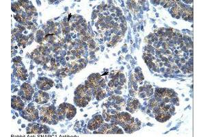 anti-Small Nuclear RNA Activating Complex, Polypeptide 1, 43kDa (SNAPC1) (C-Term) antibody