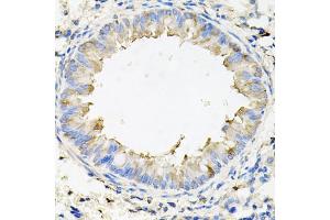 Immunohistochemistry of paraffin-embedded mouse lung using CALU antibody.