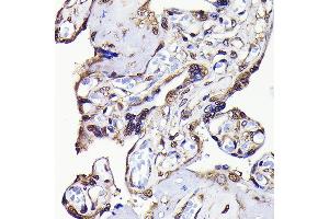 Immunohistochemistry of paraffin-embedded human placenta using GAPDH Rabbit mAb (ABIN7267454) at dilution of 1:100 (40x lens). (GAPDH Antikörper)