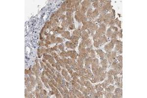 Immunohistochemical staining of human liver with PRSS38 polyclonal antibody  shows cytoplasmic positivity in hepatocytes. (PRSS38 Antikörper)