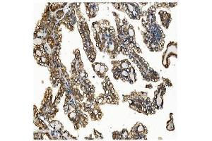 IHC analysis of VAPB using anti-VAPB antibody (ABIN5693292). (VAPB Antikörper  (AA 2-55))