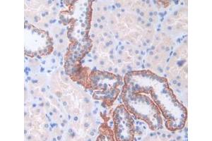 IHC-P analysis of Human Kidney Tissue, with DAB staining. (CENPI Antikörper  (AA 292-528))