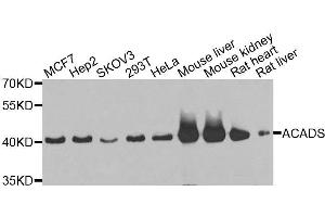 Western blot analysis of extracts of various cell lines, using ACADS antibody. (ACADS Antikörper  (AA 1-260))